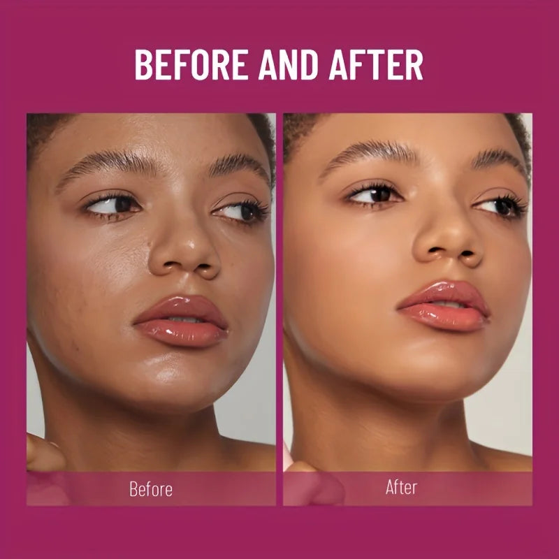 Novo corretivo com ponta de esponja para olheiras, sardas, acne, pigmentação e imperfeições. Base líquida hidratante de longa duração.